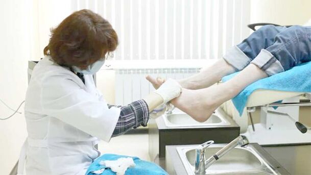 Dermatologas gydo kojų nagų grybelį
